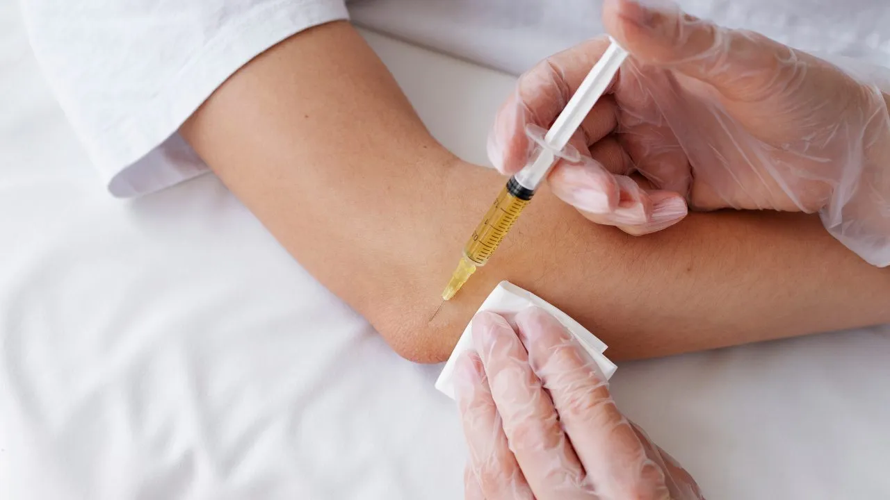 Tennis elbow - Tiêm PRP điều trị